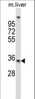 UPRT Antibody - UPRT Antibody western blot of mouse liver tissue lysates (35 ug/lane). The UPRT antibody detected the UPRT protein (arrow).