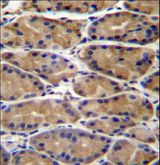 UPRT Antibody - UPRT Antibody immunohistochemistry of formalin-fixed and paraffin-embedded human stomach tissue followed by peroxidase-conjugated secondary antibody and DAB staining.