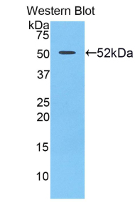 UPRT Antibody - Western blot of recombinant UPRT.  This image was taken for the unconjugated form of this product. Other forms have not been tested.