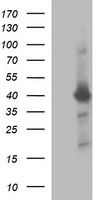 UPRT Antibody - HEK293T cells were transfected with the pCMV6-ENTRY control (Left lane) or pCMV6-ENTRY UPRT (Right lane) cDNA for 48 hrs and lysed. Equivalent amounts of cell lysates (5 ug per lane) were separated by SDS-PAGE and immunoblotted with anti-UPRT.