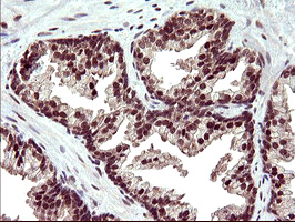 UPRT Antibody - IHC of paraffin-embedded Human prostate tissue using anti-UPRT mouse monoclonal antibody. (Heat-induced epitope retrieval by 10mM citric buffer, pH6.0, 120°C for 3min).