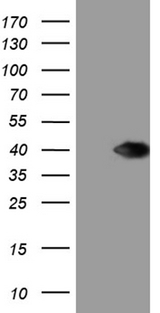 UPRT Antibody - HEK293T cells were transfected with the pCMV6-ENTRY control. (Left lane) or pCMV6-ENTRY UPRT. (Right lane) cDNA for 48 hrs and lysed. Equivalent amounts of cell lysates. (5 ug per lane) were separated by SDS-PAGE and immunoblotted with anti-UPRT. (1:2000)