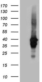 UPRT Antibody - HEK293T cells were transfected with the pCMV6-ENTRY control. (Left lane) or pCMV6-ENTRY UPRT. (Right lane) cDNA for 48 hrs and lysed. Equivalent amounts of cell lysates. (5 ug per lane) were separated by SDS-PAGE and immunoblotted with anti-UPRT. (1:2000)