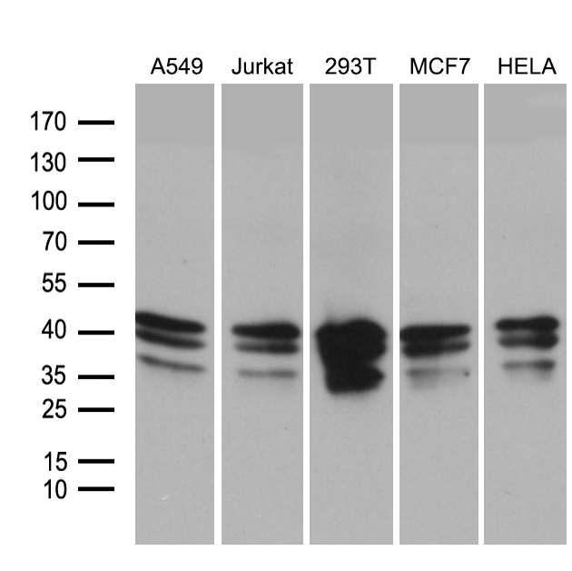 UPRT Antibody - Western blot analysis of extracts. (35ug) from 5 different cell lines by using anti-UPRT monoclonal antibody. (1:500)