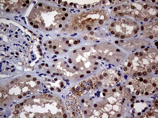 UPRT Antibody - Immunohistochemical staining of paraffin-embedded Human Kidney tissue within the normal limits using anti-UPRT mouse monoclonal antibody. (Heat-induced epitope retrieval by 1mM EDTA in 10mM Tris buffer. (pH8.5) at 120°C for 3 min. (1:1000)
