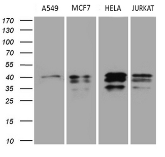 UPRT Antibody - Western blot analysis of extracts. (35ug) from 4 different cell lines by using anti-UPRT monoclonal antibody. (1:500)