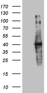 UPRT Antibody - HEK293T cells were transfected with the pCMV6-ENTRY control. (Left lane) or pCMV6-ENTRY UPRT. (Right lane) cDNA for 48 hrs and lysed