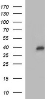 UPRT Antibody - HEK293T cells were transfected with the pCMV6-ENTRY control (Left lane) or pCMV6-ENTRY UPRT (Right lane) cDNA for 48 hrs and lysed. Equivalent amounts of cell lysates (5 ug per lane) were separated by SDS-PAGE and immunoblotted with anti-UPRT.