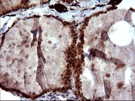 UPRT Antibody - IHC of paraffin-embedded Human thyroid tissue using anti-UPRT mouse monoclonal antibody. (Heat-induced epitope retrieval by 10mM citric buffer, pH6.0, 120°C for 3min).
