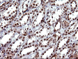 UPRT Antibody - IHC of paraffin-embedded Human Kidney tissue using anti-UPRT mouse monoclonal antibody. (Heat-induced epitope retrieval by 10mM citric buffer, pH6.0, 120°C for 3min).