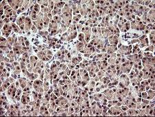 UPRT Antibody - IHC of paraffin-embedded Human pancreas tissue using anti-UPRT mouse monoclonal antibody. (Heat-induced epitope retrieval by 10mM citric buffer, pH6.0, 120°C for 3min).
