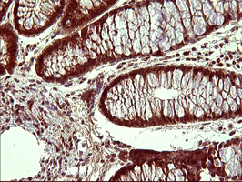 UPRT Antibody - IHC of paraffin-embedded Human colon tissue using anti-UPRT mouse monoclonal antibody. (Heat-induced epitope retrieval by 10mM citric buffer, pH6.0, 120°C for 3min).