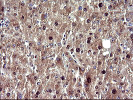 UPRT Antibody - IHC of paraffin-embedded Human liver tissue using anti-UPRT mouse monoclonal antibody. (Heat-induced epitope retrieval by 10mM citric buffer, pH6.0, 120°C for 3min).