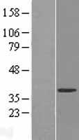 UPRT Protein - Western validation with an anti-DDK antibody * L: Control HEK293 lysate R: Over-expression lysate