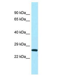 UQCC1/ UQCC Antibody - UQCC1/ UQCC antibody Western Blot of Placenta. Antibody dilution: 1 ug/ml.  This image was taken for the unconjugated form of this product. Other forms have not been tested.