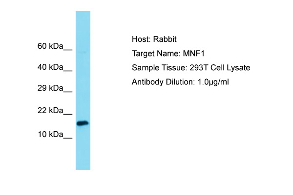 UQCC2 / MNF1 Antibody -  This image was taken for the unconjugated form of this product. Other forms have not been tested.