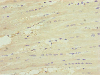 UQCC2 / MNF1 Antibody - Immunohistochemistry of paraffin-embedded human heart tissue at dilution of 1:100