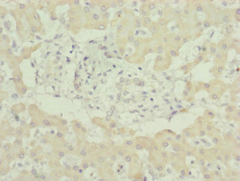 UQCC2 / MNF1 Antibody - Immunohistochemistry of paraffin-embedded human liver tissue at dilution of 1:100