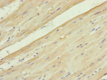UQCC2 / MNF1 Antibody - Immunohistochemistry of paraffin-embedded human heart tissue at dilution of 1:100