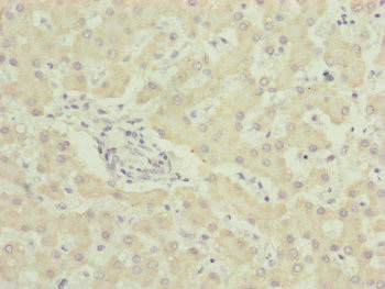 UQCC2 / MNF1 Antibody - Immunohistochemistry of paraffin-embedded human liver tissue at dilution of 1:100
