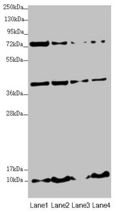 UQCC2 / MNF1 Antibody - Western blot All Lanes:UQCC2 antibody at 3.35 ug/ml Lane 1: HepG-2 whole cell lysate Lane 2: 293T whole cell lysate Lane 3: Jurkat whole cell lysate Lane 4: A431 whole cell lysate Secondary Goat polyclonal to rabbit IgG at 1/10000 dilution Predicted band size: 15 kDa Observed band size: 15,40,80 kDa