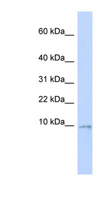 UQCR10 / UCRC Antibody - UQCR10 / UCRC antibody Western blot of MCF7 cell lysate. This image was taken for the unconjugated form of this product. Other forms have not been tested.
