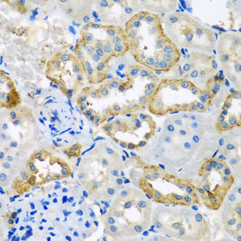 UQCR10 / UCRC Antibody - Immunohistochemistry of paraffin-embedded rat kidney tissue.