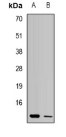 UQCR10 / UCRC Antibody - Western blot analysis of UQCR10 expression in MCF7 (A); Jurkat (B) whole cell lysates.