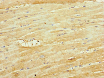 UQCR10 / UCRC Antibody - Immunohistochemistry of paraffin-embedded human heart tissue at dilution of 1:100