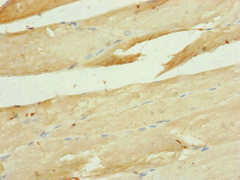 UQCR10 / UCRC Antibody - Immunohistochemistry of paraffin-embedded human skeletal muscle tissue at dilution of 1:100