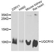 UQCR10 / UCRC Antibody - Western blot analysis of extracts of various cell lines, using UQCR10 antibody at 1:1000 dilution. The secondary antibody used was an HRP Goat Anti-Rabbit IgG (H+L) at 1:10000 dilution. Lysates were loaded 25ug per lane and 3% nonfat dry milk in TBST was used for blocking. An ECL Kit was used for detection and the exposure time was 30s.
