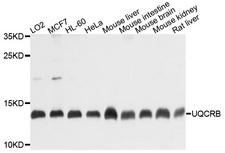 UQCRB Antibody - Western blot analysis of extracts of various cell lines, using UQCRB antibody at 1:1000 dilution. The secondary antibody used was an HRP Goat Anti-Rabbit IgG (H+L) at 1:10000 dilution. Lysates were loaded 25ug per lane and 3% nonfat dry milk in TBST was used for blocking. An ECL Kit was used for detection and the exposure time was 10s.