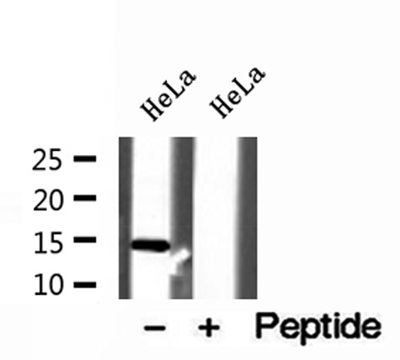 UQCRB Antibody - Western blot analysis of extracts of HeLa cells using UQCRB antibody.
