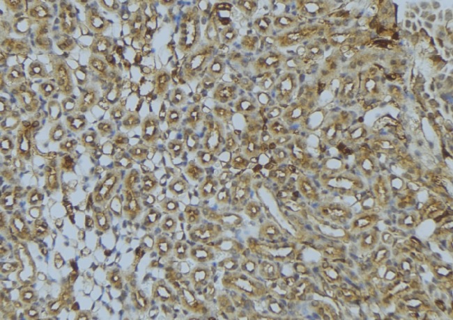 UQCRB Antibody - 1:100 staining mouse kidney tissue by IHC-P. The sample was formaldehyde fixed and a heat mediated antigen retrieval step in citrate buffer was performed. The sample was then blocked and incubated with the antibody for 1.5 hours at 22°C. An HRP conjugated goat anti-rabbit antibody was used as the secondary.