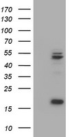 UQCRC1 Antibody - HEK293T cells were transfected with the pCMV6-ENTRY control (Left lane) or pCMV6-ENTRY UQCRC1 (Right lane) cDNA for 48 hrs and lysed. Equivalent amounts of cell lysates (5 ug per lane) were separated by SDS-PAGE and immunoblotted with anti-UQCRC1.