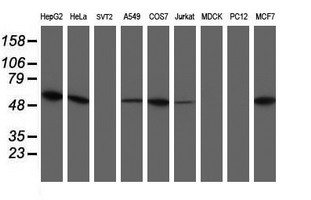 UQCRC1 Antibody - Western blot of extracts (35ug) from 9 different cell lines by using anti-UQCRC1 monoclonal antibody (HepG2: human; HeLa: human; SVT2: mouse; A549: human; COS7: monkey; Jurkat: human; MDCK: canine; PC12: rat; MCF7: human).