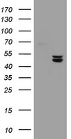 UQCRC1 Antibody - HEK293T cells were transfected with the pCMV6-ENTRY control (Left lane) or pCMV6-ENTRY UQCRC1 (Right lane) cDNA for 48 hrs and lysed. Equivalent amounts of cell lysates (5 ug per lane) were separated by SDS-PAGE and immunoblotted with anti-UQCRC1.