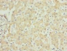 UQCRC1 Antibody - Immunohistochemistry of paraffin-embedded human liver tissue at dilution of 1:100