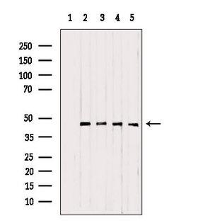 UQCRC1 Antibody - Western blot analysis of extracts of various samples using UQCRC1 antibody. Lane 1: rat brain treated with blocking peptide. Lane 2: rat brain; Lane 3: 293; Lane 4: mouse myeloma; Lane 5: B16F10;