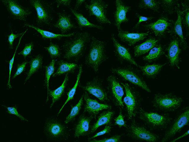UQCRC1 Antibody - Immunofluorescence staining of UQCRC1 in Hela cells. Cells were fixed with 4% PFA, permeabilzed with 0.1% Triton X-100 in PBS, blocked with 10% serum, and incubated with rabbit anti-Human UQCRC1 polyclonal antibody (dilution ratio 1:200) at 4°C overnight. Then cells were stained with the Alexa Fluor 488-conjugated Goat Anti-rabbit IgG secondary antibody (green) and counterstained with DAPI (blue). Positive staining was localized to Cytoplasm.
