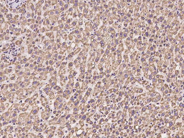 UQCRC1 Antibody - Immunochemical staining of human UQCRC1 in human liver with rabbit polyclonal antibody at 1:100 dilution, formalin-fixed paraffin embedded sections.