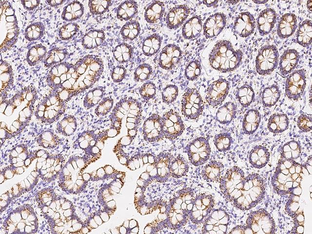 UQCRC1 Antibody - Immunochemical staining of human UQCRC1 in human small intestine with rabbit polyclonal antibody at 1:1000 dilution, formalin-fixed paraffin embedded sections.
