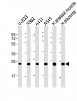 UQCRFS1 Antibody - All lanes: Anti-UQCRFS1P1 Antibody (Center) at 1:2000 dilution. Lane 1: U-2OS whole cell lysate. Lane 2: K562 whole cell lysate. Lane 3: A431 whole cell lysate. Lane 4: A549 whole cell lysate. Lane 5: human skeletal muscle lysate. Lane 6: human placenta lysate Lysates/proteins at 20 ug per lane. Secondary Goat Anti-Rabbit IgG, (H+L), Peroxidase conjugated at 1:10000 dilution. Predicted band size: 31 kDa. Blocking/Dilution buffer: 5% NFDM/TBST.