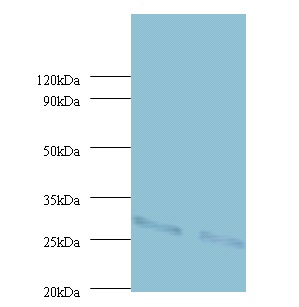 UQCRFS1 Antibody - Western Blot: UQCRFS1 antibody at 2 µg/ml. Lane 1 : EC109 whole cell lysate. Lane 2 : 293T whole cell lysate.  This image was taken for the unconjugated form of this product. Other forms have not been tested.