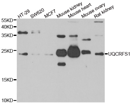 UQCRFS1 Antibody - Western blot analysis of extracts of various cell lines.