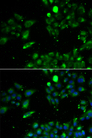 UQCRFS1 Antibody - Immunofluorescence analysis of U2OS cells.
