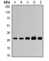UQCRFS1 Antibody - Western blot analysis of RISP expression in SW620 (A); MCF7 (B); mouse heart (C); mouse ovary (D); rat kidney (E) whole cell lysates.