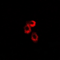 UQCRFS1 Antibody - Immunofluorescent analysis of RISP staining in U2OS cells. Formalin-fixed cells were permeabilized with 0.1% Triton X-100 in TBS for 5-10 minutes and blocked with 3% BSA-PBS for 30 minutes at room temperature. Cells were probed with the primary antibody in 3% BSA-PBS and incubated overnight at 4 deg C in a humidified chamber. Cells were washed with PBST and incubated with a DyLight 594-conjugated secondary antibody (red) in PBS at room temperature in the dark.