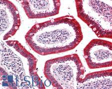 UQCRQ Antibody - Human Small Intestine: Formalin-Fixed, Paraffin-Embedded (FFPE)