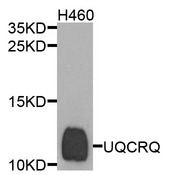 UQCRQ Antibody - Western blot analysis of extracts of H460 cells.